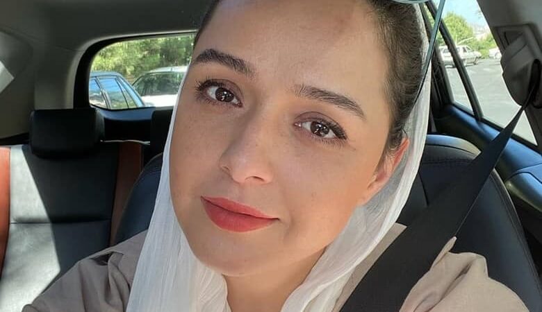 کدام بازیگر زن عمل زیبایی نکرده اند؟ + عکس بازیگران با چهره طبیعی