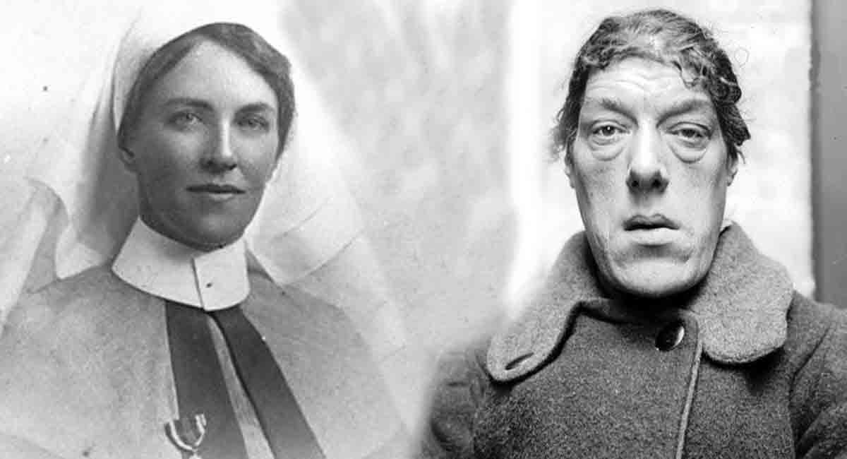 پرستار زیبا یک شبه زشتترین زن دنیا شد!