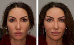 عجیب و غریب؛ این عمل جراحی رنگ چشم شما را تغییر میدهد!