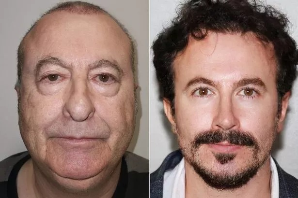 عجیب و غریب؛ جراحی پلاستیک این مرد را به کلی تغییر داده!!